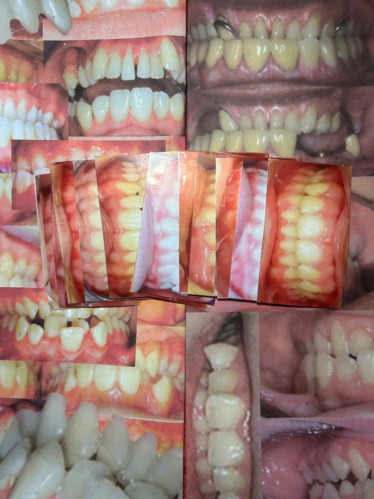 Teeth sticker set